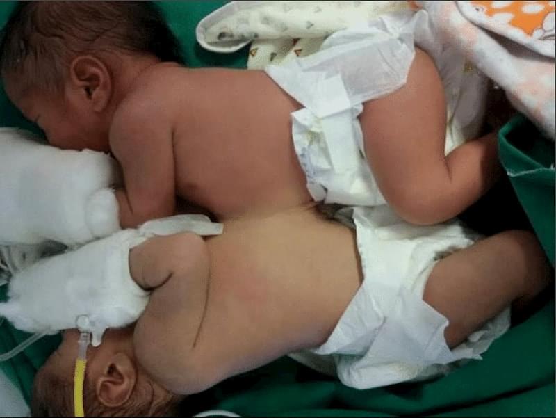 Двуплодная беременность